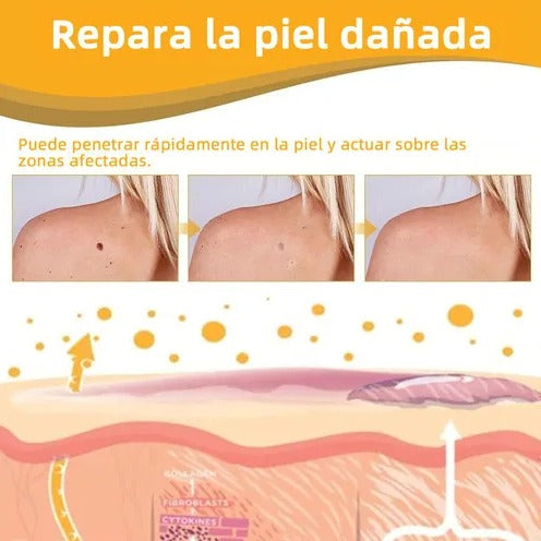 SkinVanish Pro Transforma tu piel y recupera tu confianza