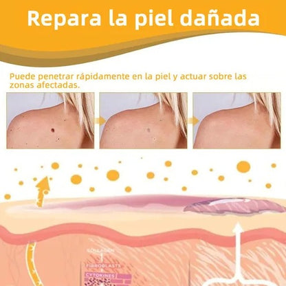 SkinVanish Pro Transforma tu piel y recupera tu confianza