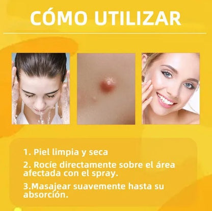 SkinVanish Pro Transforma tu piel y recupera tu confianza